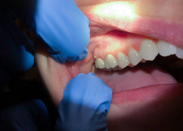 Best Emergency Dental Services for Seniors in South Park, WY